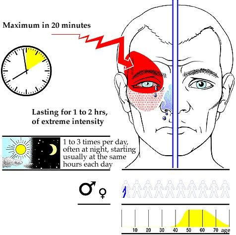 a diagram of a person's face